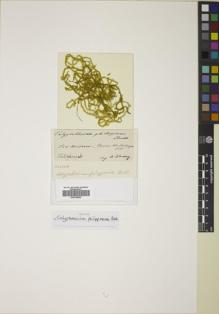 Type specimen at Edinburgh (E). Warburg, Otto: . Barcode: E00758402.